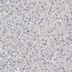 Immunohistochemical staining of human liver shows no positivity in hepatocytes as expected.