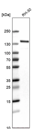 Western blot analysis in human cell line RH-30.