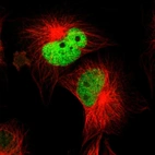 Immunofluorescent staining of human cell line U-251 MG shows localization to nucleoplasm.