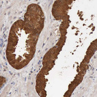 Anti-PTGR2 Antibody