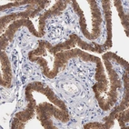 Immunohistochemical staining of human fallopian tube shows moderate cytoplasmic positivity in glandular cells.