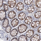 Immunohistochemical staining of human colon shows moderate cytoplasmic positivity in glandular cells.