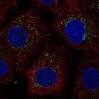 Immunofluorescent staining of human cell line A549 shows localization to vesicles.