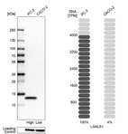 Anti-LGALS1 Antibody