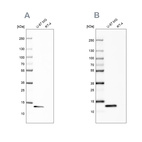 Anti-LGALS1 Antibody