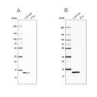 Western blot analysis using Anti-LGALS1 antibody HPA001130 (A) shows similar pattern to independent antibody HPA000687 (B).