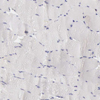 Immunohistochemical staining of human skeletal muscle shows no positivity in myocytes as expected.