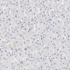Immunohistochemical staining of human liver shows no positivity in hepatocytes as expected.