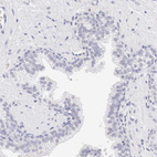 Immunohistochemical staining of human prostate shows no positivity in glandular cells as expected.