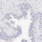 Immunohistochemical staining of human prostate shows no positivity in glandular cells as expected.
