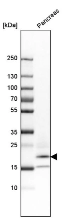 Western blot analysis in human pancreas tissue.