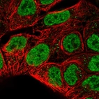 Immunofluorescent staining of human cell line RT4 shows localization to nucleoplasm & vesicles.