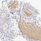 Immunohistochemical staining of human fallopian tube shows moderate positivity in erythrocytes.