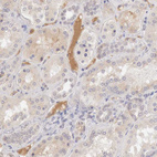 Anti-CFI Antibody