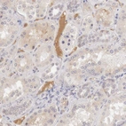 Immunohistochemical staining of human kidney shows moderate positivity in plasma.