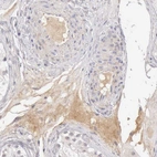 Immunohistochemical staining of human testis shows moderate positivity in plasma.