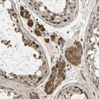 Anti-VCPKMT Antibody