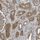 Immunohistochemical staining of human kidney shows moderate cytoplasmic positivity in cells in tubules.