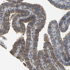 Immunohistochemical staining of human fallopian tube shows weak cytoplasmic positivity in glandular cells.