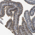 Immunohistochemical staining of human fallopian tube shows weak cytoplasmic positivity in glandular cells.