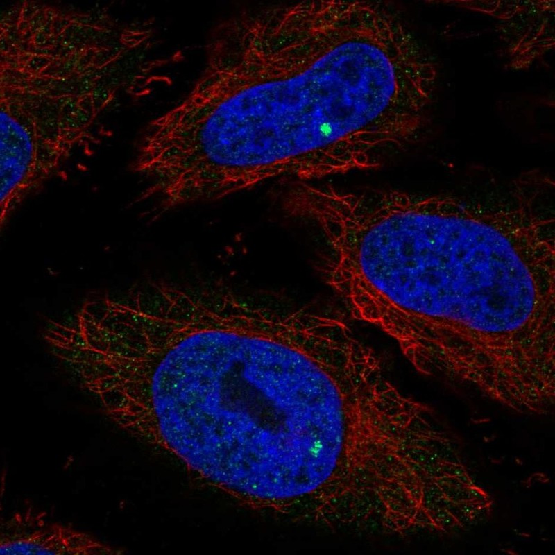 Anti-RIBC1 Antibody