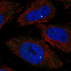 Anti-RIBC1 Antibody