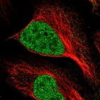 Anti-MNAT1 Antibody