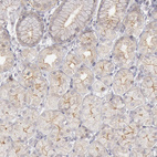 Anti-JOSD1 Antibody