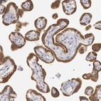 Immunohistochemical staining of human placenta shows moderate cytoplasmic positivity in trophoblastic cells.