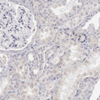 Anti-JOSD1 Antibody