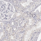 Immunohistochemical staining of human kidney shows weak cytoplasmic positivity in cells in tubules.