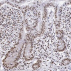 Anti-SNRPD3 Antibody