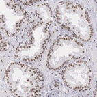 Anti-SNRPD3 Antibody