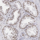 Immunohistochemical staining of human prostate shows moderate nuclear positivity in glandular cells.