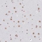 Immunohistochemical staining of human cerebral cortex shows moderate nuclear positivity in neuronal cells.