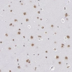 Immunohistochemical staining of human cerebral cortex shows moderate nuclear positivity in neuronal cells.
