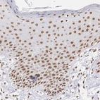 Immunohistochemical staining of human skin shows moderate to strong nuclear positivity in squamous epithelial cells.
