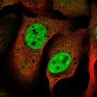 Immunofluorescent staining of human cell line U-2 OS shows localization to nucleoplasm & nuclear bodies.