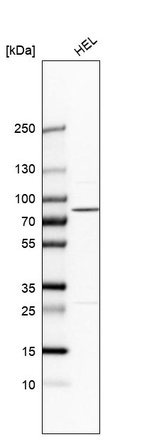 Anti-PLA2G6 Antibody