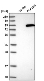 Anti-PLA2G6 Antibody
