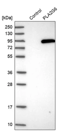 Western blot analysis in control (vector only transfected HEK293T lysate) and PLA2G6 over-expression lysate (Co-expressed with a C-terminal myc-DDK tag (~3.1 kDa) in mammalian HEK293T cells, LY400377).