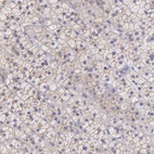 Anti-TBC1D22A Antibody