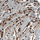 Anti-PIGA Antibody