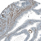 Immunohistochemical staining of human Prostate shows moderate granular cytoplasmic positivity in smooth muscle cells.