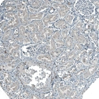 Immunohistochemical staining of human Kidney shows moderate granular cytoplasmic positivity in cells in tubules.