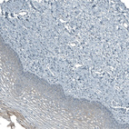 Immunohistochemical staining of human Skin shows very weak granular cytoplasmic positivity in squamous epithelial cells.