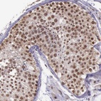 Anti-PRPF39 Antibody