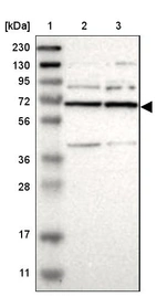 Lane 1: Marker [kDa] 230, 130, 95, 72, 56, 36, 28, 17, 11_br/_Lane 2: Human cell line RT-4_br/_Lane 3: Human cell line U-251MG sp