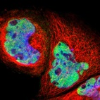 Immunofluorescent staining of human cell line A-431 shows localization to nucleoplasm.