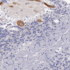 Anti-LRFN5 Antibody